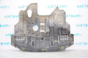 Engine protection Kia Forte 4d 17-18 rest, no covers