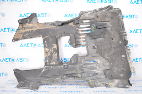 Nissan Sentra 20-23 Engine Guard Tears