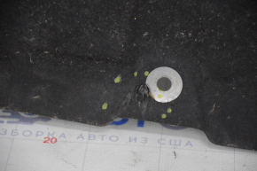 Engine protection Hyundai Santa FE 19-20 2.0, 2.4 tears