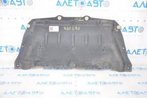 Engine protection BMW 7 G11 G12 16-22 front RWD breaks, cracks