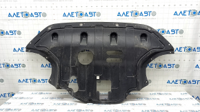 Engine protection Hyundai Kona 18-21 2.0 usa