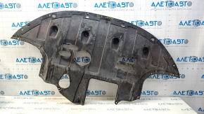 Engine protection Hyundai Elantra AD 17-20 2.0 dents, cracks