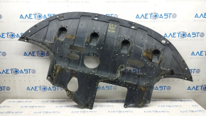 Engine protection Hyundai Elantra AD 17-20 2.0 is broken, rubbed