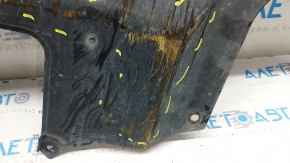 Engine protection Hyundai Elantra AD 17-20 2.0 is broken, rubbed
