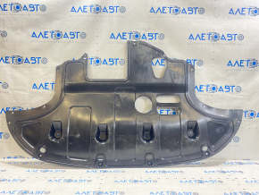 Engine protection Kia Forte 19-24 2.0 FPS