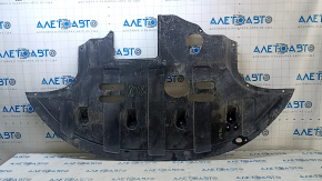 Hyundai Elantra AD 17-20 2.0 engine guard tear