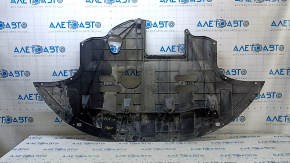 Hyundai Elantra AD 17-20 2.0 engine guard tear