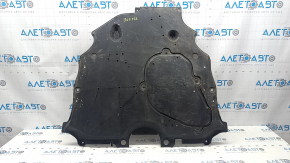 The engine guard on my Toyota Rav4 19-24 is worn out.