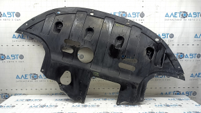 The engine guard on the Hyundai Elantra AD 17-20 2.0 is worn out.