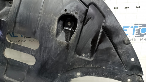 The engine guard on the Hyundai Elantra AD 17-20 2.0 is worn out.