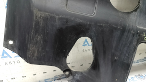 The engine guard on the Hyundai Elantra AD 17-20 2.0 is worn out.