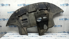 The engine guard on the Hyundai Elantra AD 17-20 2.0 is worn out.