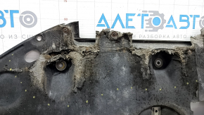 Engine protection Kia Niro 17-22 HEV, PHEV tears, missing fragment