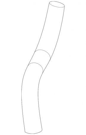 Upper cooling hose Hyundai Elantra 21-24 2.0 second