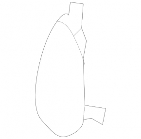 Mercedes W213 E 17-20 AMG Front Bumper Tow Hook Cap (package)